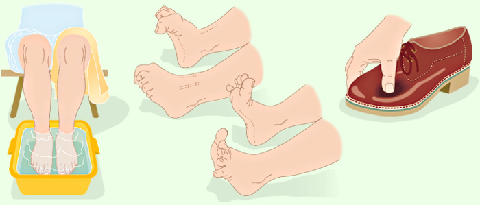 Fußpflegetipps für Diabetiker